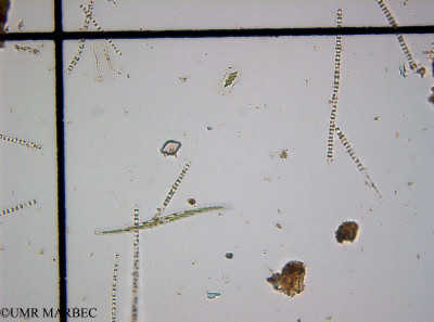 phyto/Guinea golf/Wouri_estuary_Chenal_2/YNkouefuthNfongmo_these 2022-2023/Rhaphoneis sp2 (Chenal2_SURF_2023_iden24230626_001).TIF(copy)_thumb.jpg